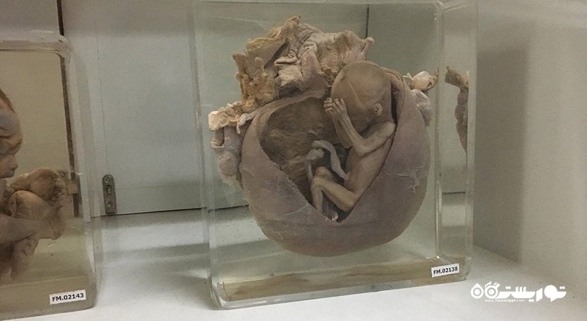 موزه پزشکی بانکوک -  شهر بانکوک